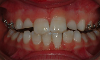 Patient 2 | The Orthodontic Studio After Photo