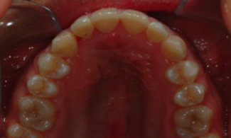 Patient 3 | The Orthodontic Studio After Photo